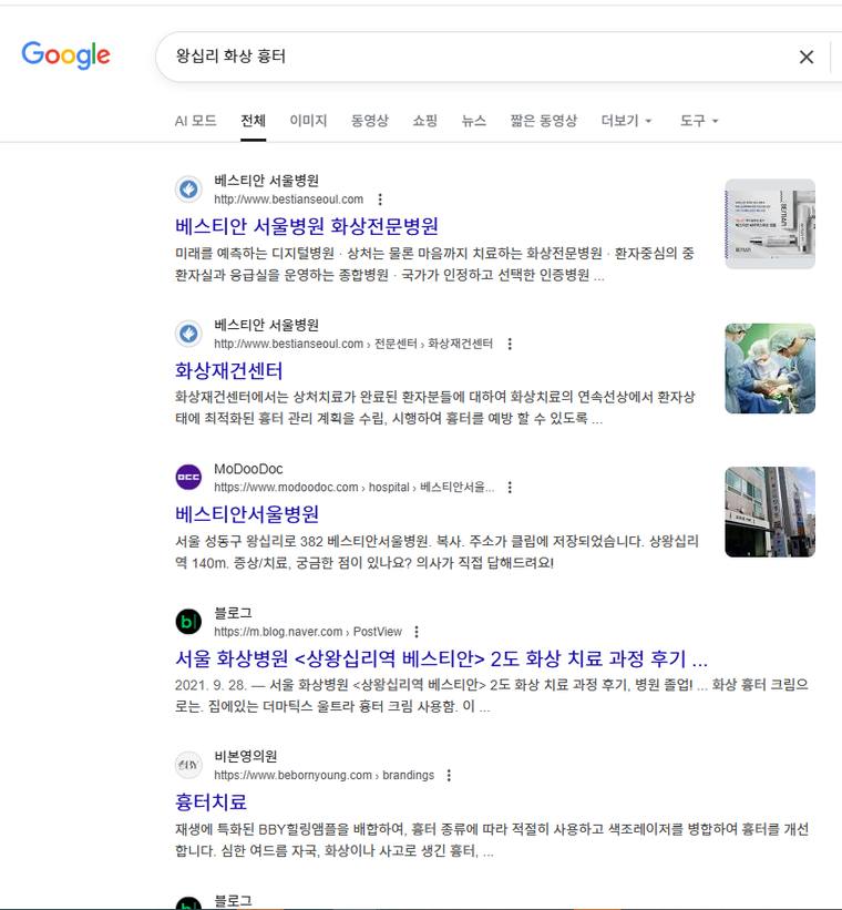 베스티안서울병원 — Google에서 «왕십리 화상 흉터» 검색 결과 캡처