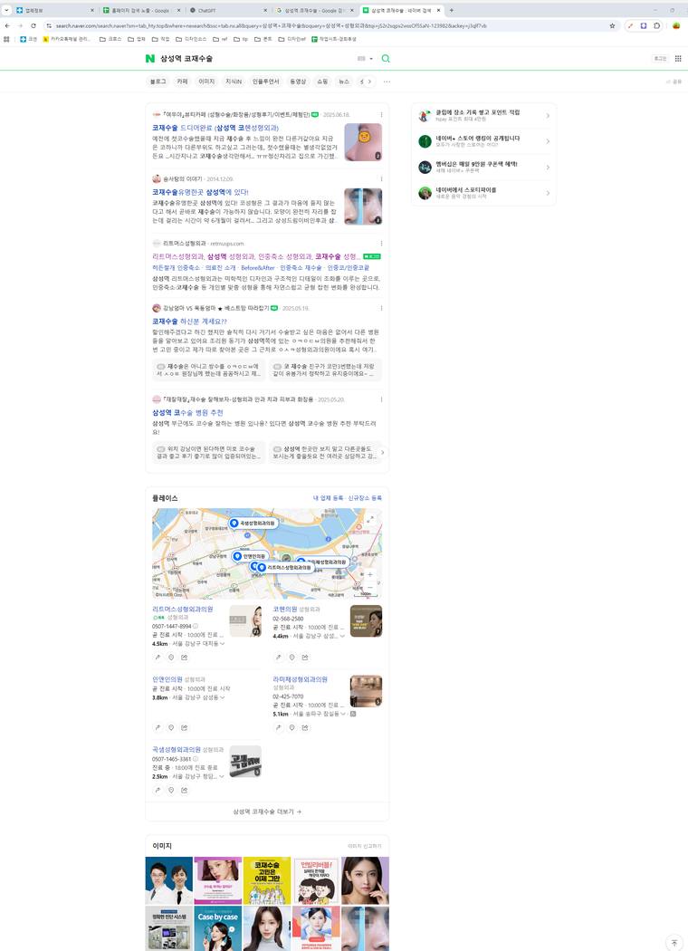 리트머스성형외과 — Naver에서 «삼성역 코재수술» 검색 결과 캡처