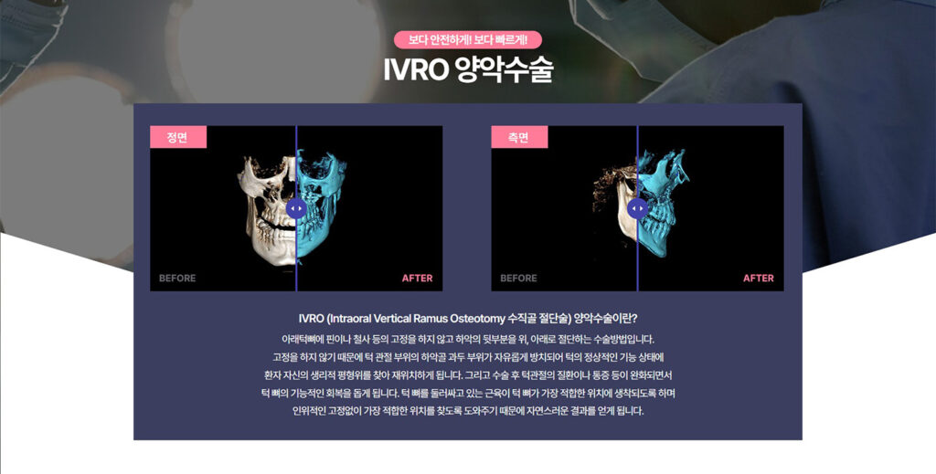 portfolio_sub_everm_img08