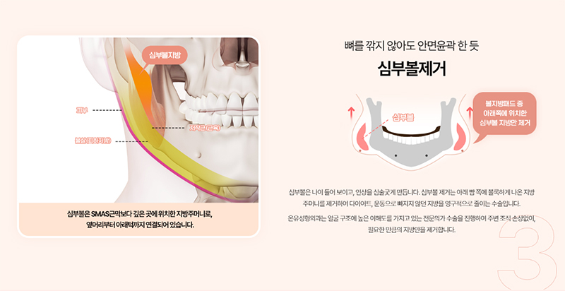 성형외과 홈페이지 제작, 섬진료 일러스트, 적절한 정보 배치