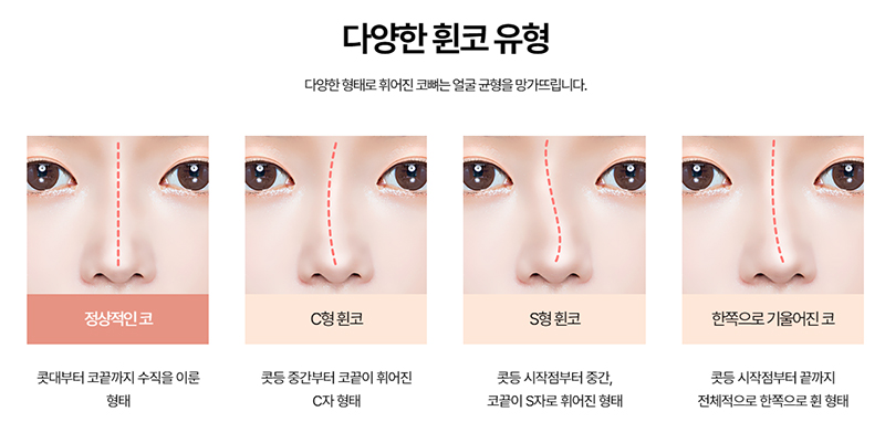 성형외과 홈페이지 제작, 한눈에 들어오는 그림, 이해하기 쉬운 표현