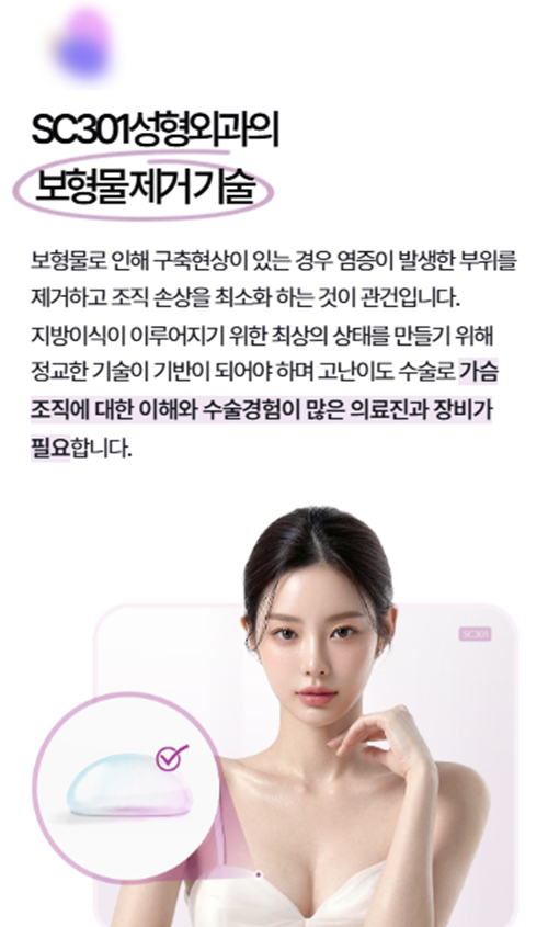 sc301성형외과 모바일 이미지