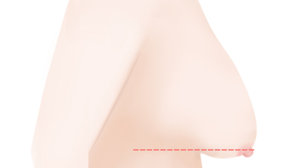 sc301성형외과 일러스트 이미지