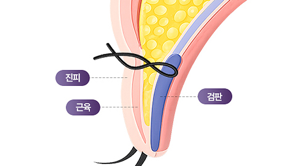 리네성형외과 일러스트 이미지