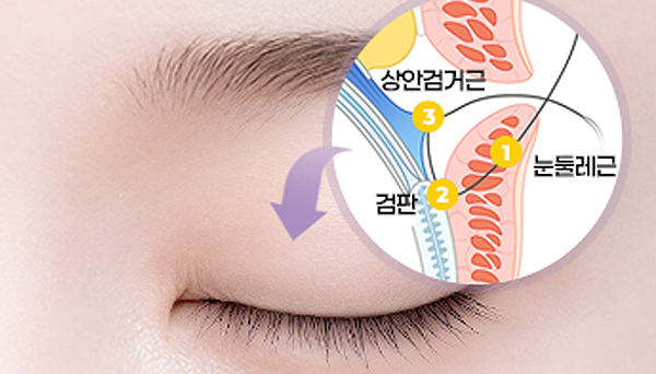 리네성형외과 일러스트 이미지