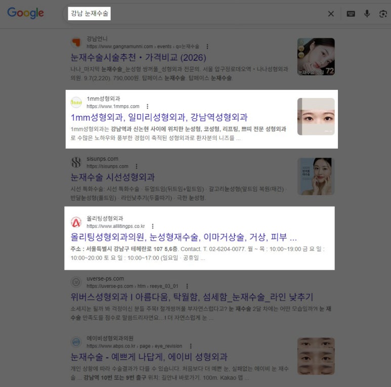 성형외과 홈페이지 SEO 검색 노출과 GEO AEO 구조